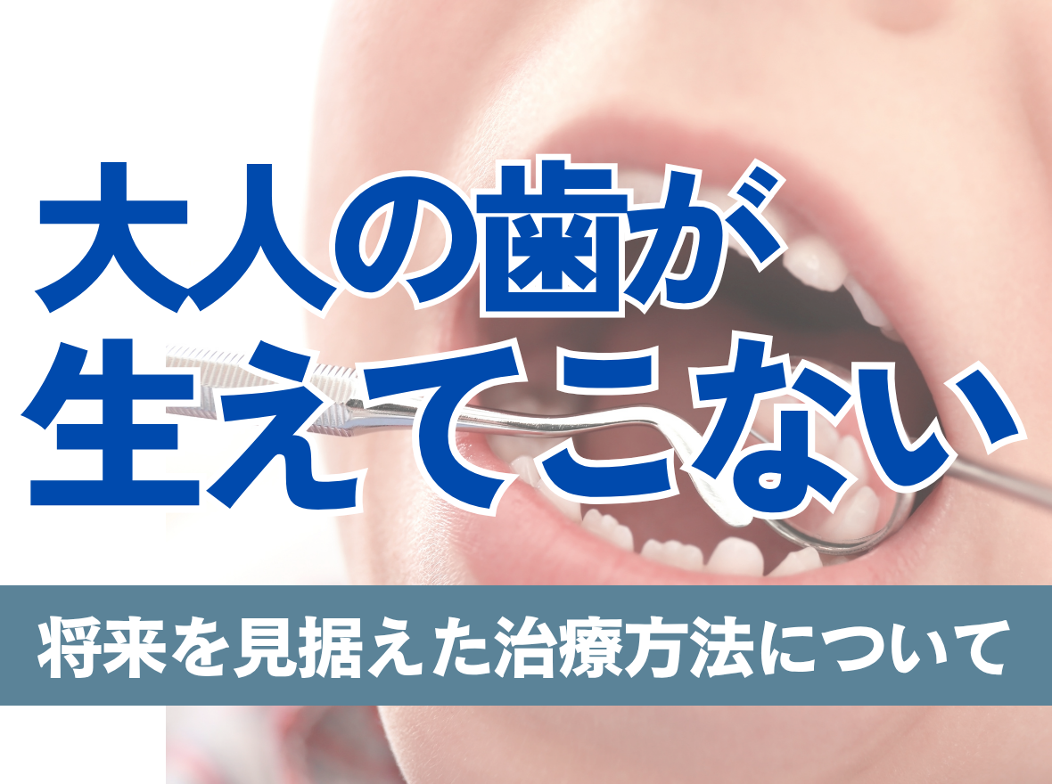 大人の歯が生えてこなくて不安…先天性欠如歯について