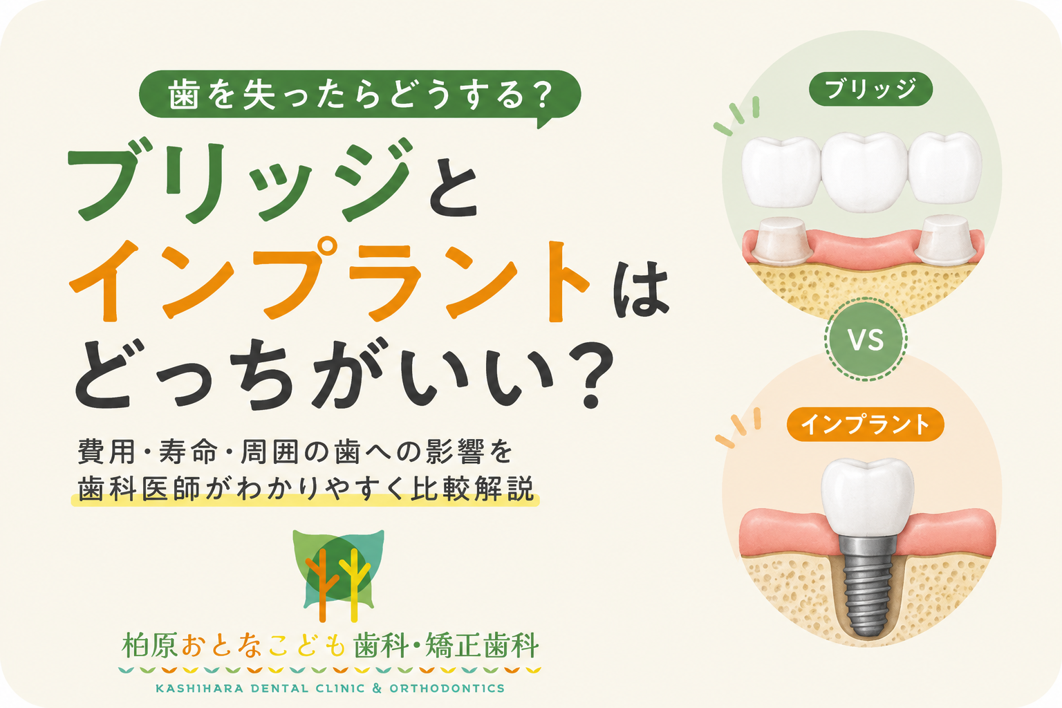 ブリッジとインプラントはどっちがいい？費用・寿命・周囲の歯への影響まで歯科医師が解説