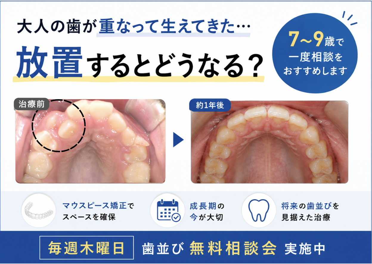 「大人の歯が重なって生えてきた…」放置するとどうなる？7〜9歳で矯正相談をおすすめする理由
